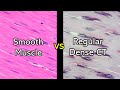 Understanding Smooth Muscle and Dense Regular Connective Tissue