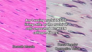 Practice | Smooth Muscle vs Dense Regular Connective Tissue