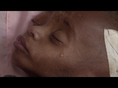 Vídeo: Fome Na Somália. Ainda Está Acontecendo. - Rede Matador