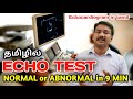 Echo test report in tamil  echo normal or abnormal in 9 min  echocardiogram in tamil