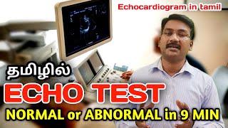 Echo test report in tamil | echo normal or abnormal in 9 min | Echocardiogram in tamil