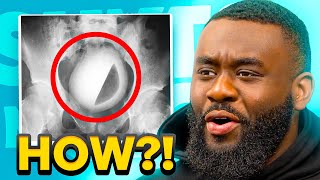 HE GOT A COCONUT STUCK IN HIS...?! | ShxtsNGigs Clips