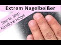 Nagelbeißer Extrem / Nagelmodellage Step by Step