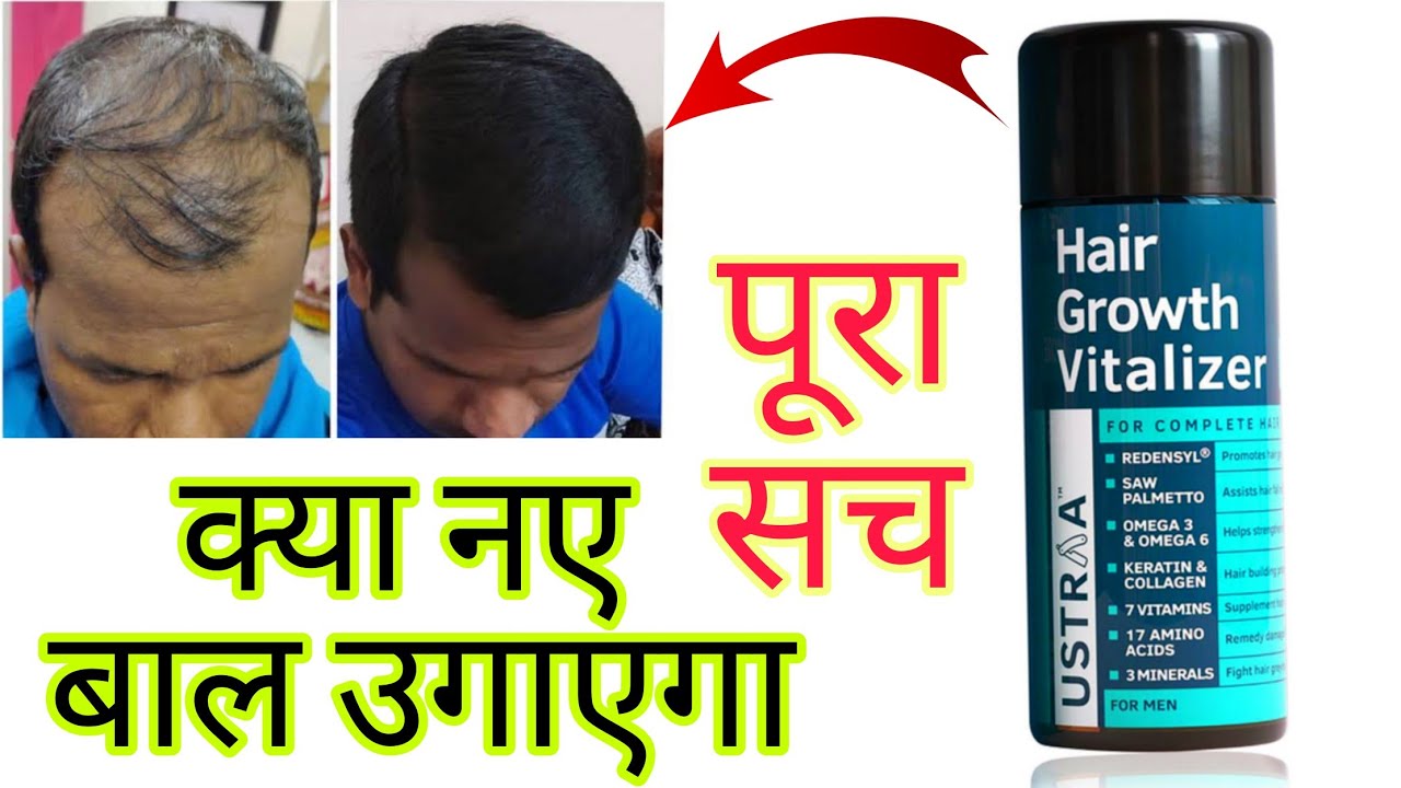 Ustraa Hair Growth Vitalizer HONEST Review 2022 In Hindi | Results,  Benefits, Uses, Price Info - YouTube