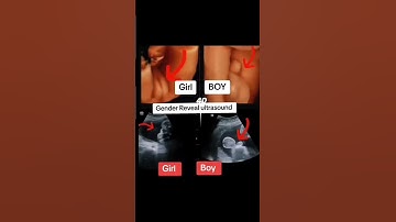 4D Ultrasound Scan View #shorts video #4dultrasound