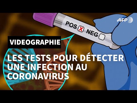 Tests pour détecter une infection au nouveau coronavirus | AFP Animé Tests pour détecter une infection au nouveau coronavirus | AFP Animé
