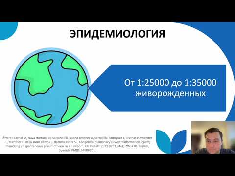 14. ТЕРНИСТЫЙ ПУТЬ
