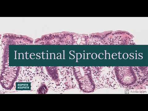 Video: Spirochetosis inamaanisha nini?