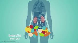 Membrane Series: Fighting Uremic Toxins