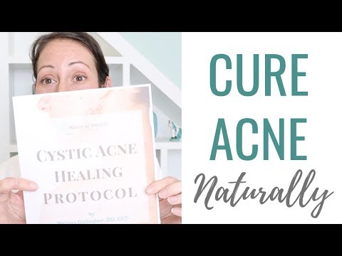 How to Get Rid Of Cystic Acne and Rosacea Naturally |The ULTIMATE Acne & Acne Scar Cure