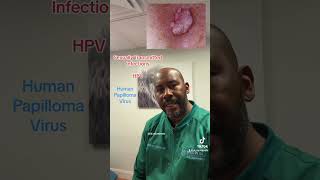 Medicine: Beyond the Basics. HPV the basics. @Dr_rejuvenate
