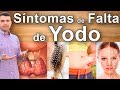 8 Síntomas de la Falta de Yodo - Caída de Cabello, Subir de Peso Estreñimiento Cansancio y Piel Seca