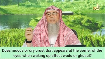 Mucus or dry crust that appear at corner of eyes when you wake up impact wudu, ghusl?Assim al hakeem