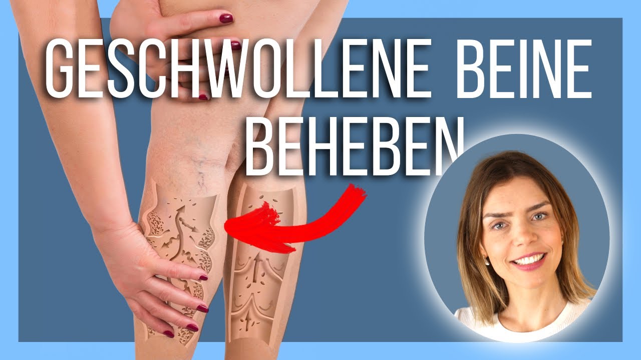 Wie Lange Ist Das Bein Nach Hüft Tep Geschwollen Meine BESTEN Übungen gegen geschwollene Beine und Füße (Ödeme) - YouTube