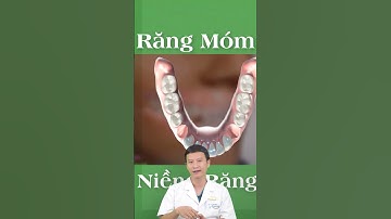 Niềng Răng Móm?! | Nha Khoa Minh Châu