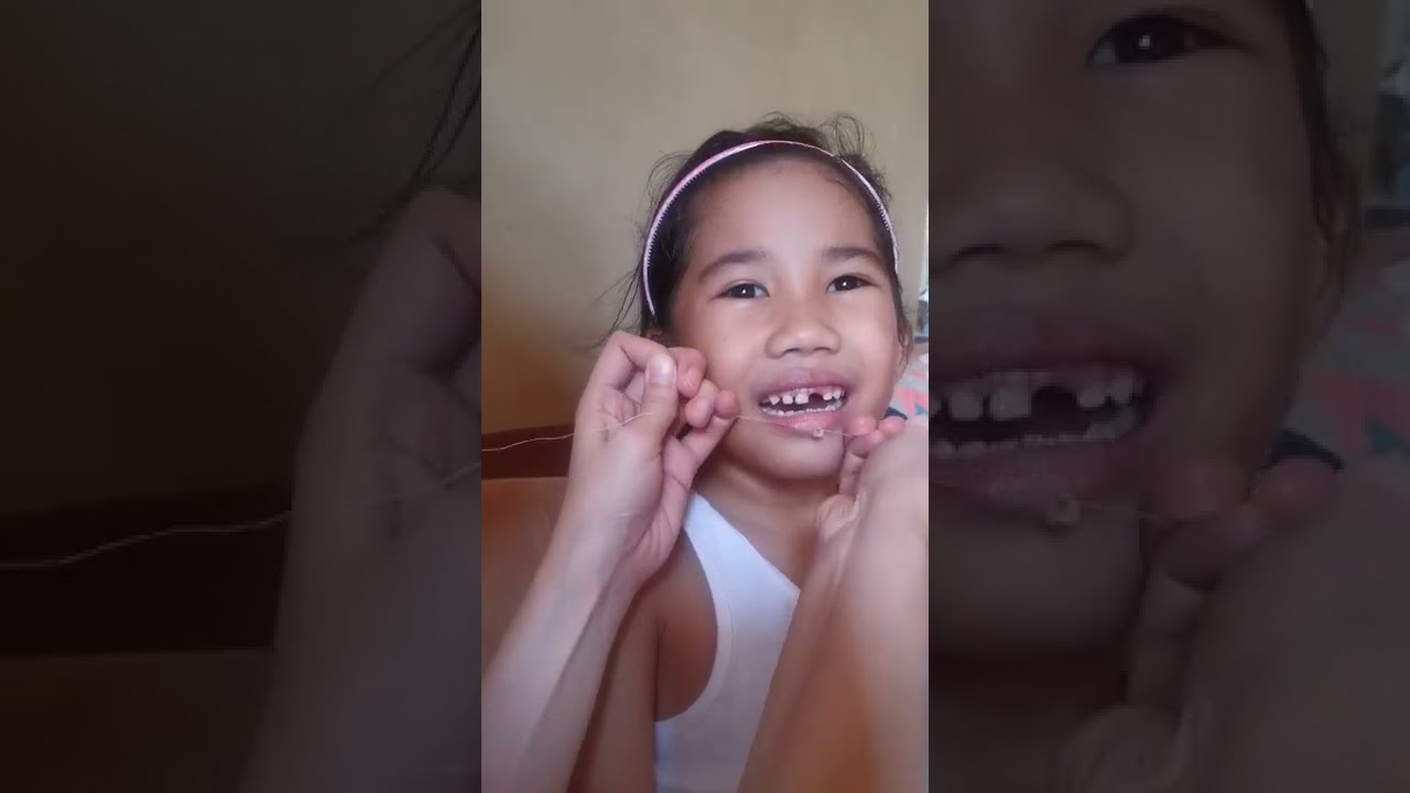 How To Remove Milk Teeth Using Thread