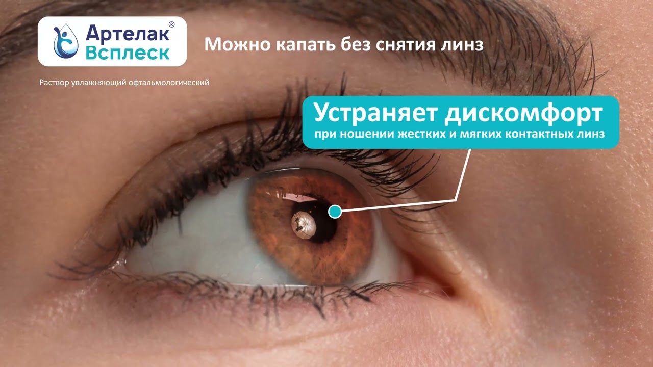 Артелак Всплеск РУС