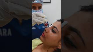 15-Minute Nose Transformation No Surgery Needed