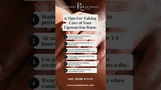 6 Tips For Taking Care of Your Liposuction Burn