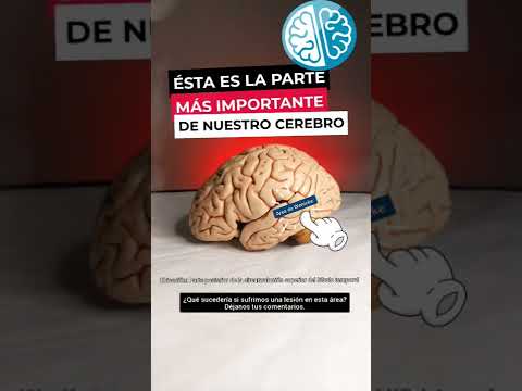 Área de Wenicke