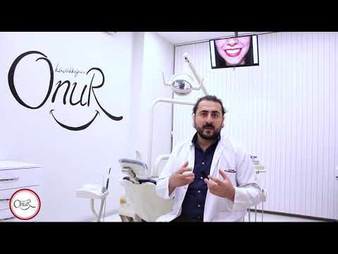 Konya Özel Diş Hekimi Onur Küçükkağnıcı - Diş Taşı Temizliği İmplant Tavsiye Dişeti Kanaması Dişteli Konya Özel Diş Hekimi Onur Küçükkağnıcı - Diş Taşı Temizliği İmplant Tavsiye Dişeti Kanaması Dişteli