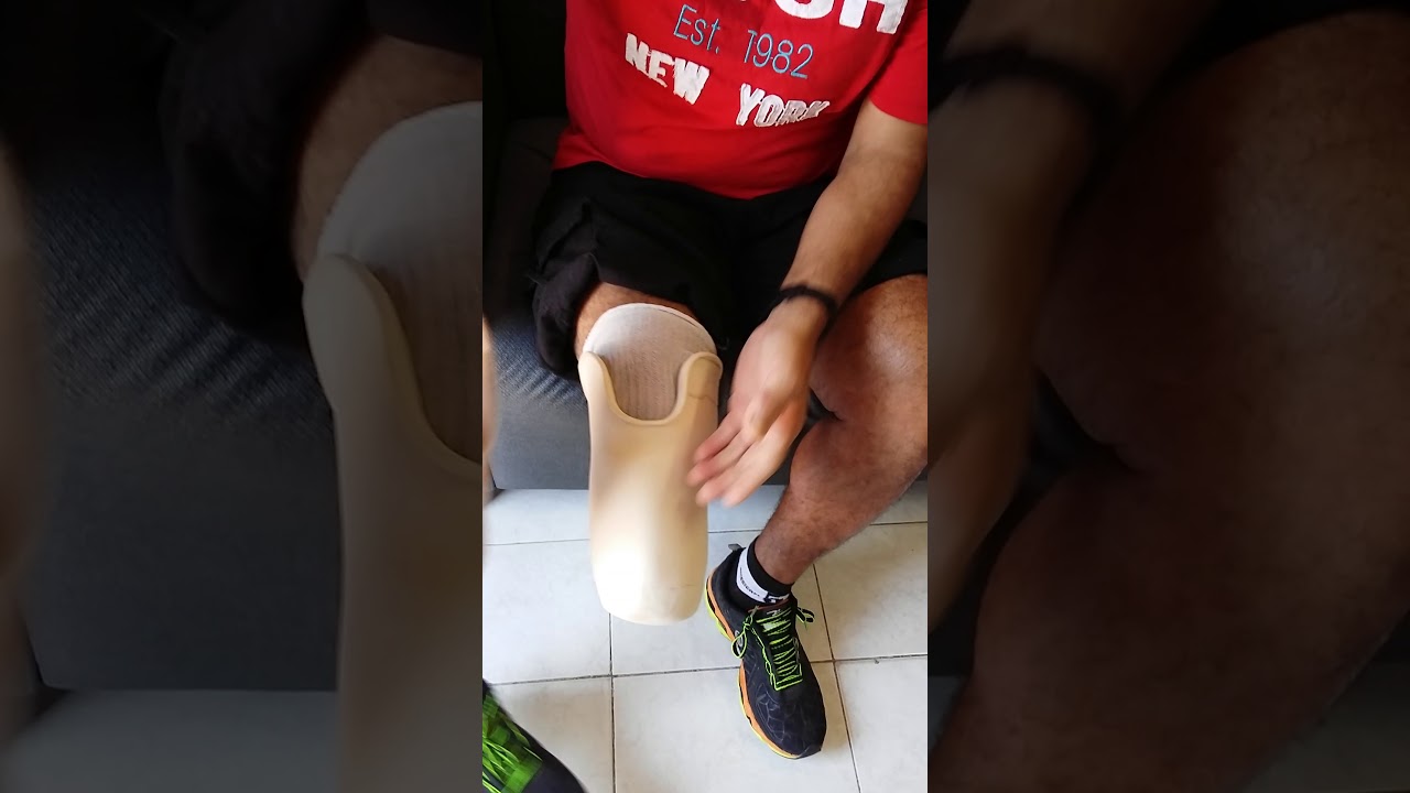 CALÇANDO PROTESE COM SISTEMA K.B.M