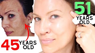THIS TRANSFORMED MY SKIN!!!