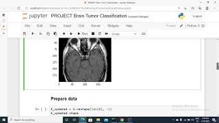 Brain Tumor Classification MRI | Brain Tumor Detection using Support Vector Machine in Python