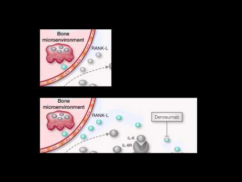 Vídeo: Respirar Una Nueva Vida En Un Viejo Objetivo: Medicamentos Para La Enfermedad Pulmonar Para La Terapia De La Enfermedad De Parkinson