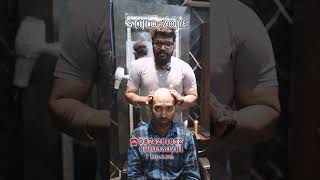 😍 Hair Patch Kolkata | 50% OFF Limited Offer Hair patch price in kolkatahair fixing #HairLoss