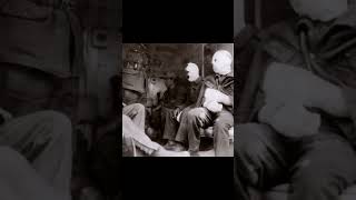 The effects of mustard gas #ww1 #warhistory #warshorts #military