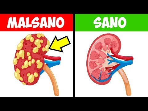 Video: Perché il succo di cavolo è utile per il corpo