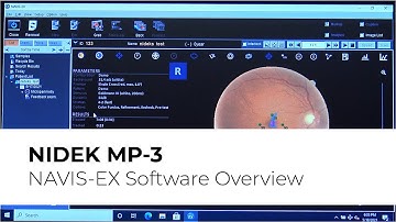 NIDEK MP-3 Microperimeter | NAVIS-EX Software Overview