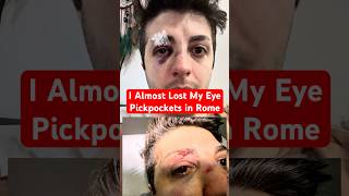 ⛔️I Almost Lost My Eye in Metro in Rome #Pickpockets #Pickpocket #Termini #Carterista #Borseggiatori