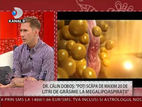 Dr. Calin Dobos a explicat pe intelesul tuturor ce inseamna liposuctia sau lipoaspiratia