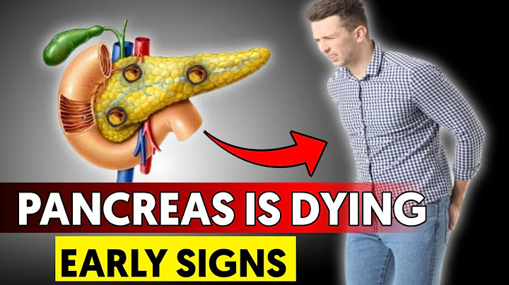 Warning Signs of Pancreatic Disease (That Could Save Your Life!)
