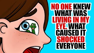 No One Knew What Was Living In My Eye. What Caused It Shocked Everyone