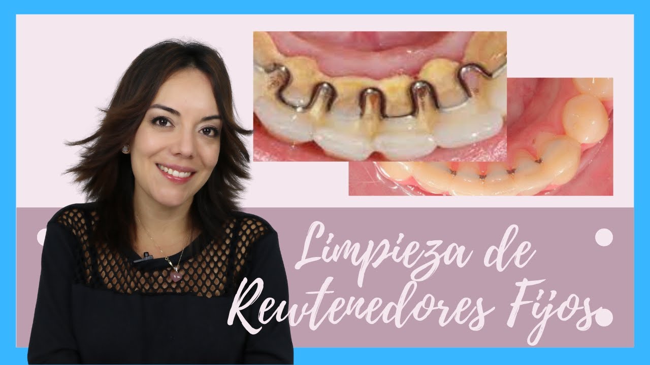 COMO LIMPIO MI RETENEDOR FIJO? - AQUI TE LO EXPLICO