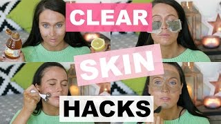 ♡ 10 LIFE HACKS for CLEAR & FLAWLESS SKIN ♡
10 life hacks for clear and flawless skin! Today Im taking you through some simple tips for clearer skin, including DIY masks and tips that everyone can do at home! EXPAND!
Want more? Subscribe to my channel:
http://bit.ly/HollySheeran
Watch my last video:
http://bit.ly/2oKfkS2
WHERE ELSE TO FIND ME
Facebook: http://facebook.com/twinklelashes.9
Twitter: http://twitter.com/hollysheerantv
Instagram: http://instagram.com/xhollysheeranx
PO BOX:
Holly Sheeran
Vermont House
Nottingham South and Wilford Ind. Est
NG11 7HQ
♡ ♡
♡ Stuff Mentioned ♡
Makeup For Ever Instant Brush Cleanser
LOreal Paris Pure Clay Detox Foam Wash
LOreal Paris Pure Clay Foam Wash Red
The Body Shop Himalayan Charcoal Purifying Glow Mask
The Body Shop Ethiopian Honey Deep Nourishing Mask
The Body Shop Facial Mask Brush
The Body Shop Skin defence Multi-Protection Essence SPF50
MAC Studio Fix Fluid SPF15
The Body Shop Oils Of Life Twin-Ball Facial Massager
♡ ♡
♡ What Im Wearing ♡
Next Jumper
♡ ♡
Disclaimer: I was not paid or sponsored to make this video. ♡ 10 LIFE HACKS for CLEAR & FLAWLESS SKIN ♡