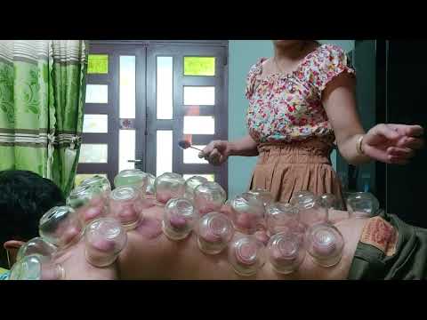 Video 5 tháng 4, 2022 HƯỚNG DẪN CACH GIÁC HƠI ,CHỮA BỆNH... - youtube
