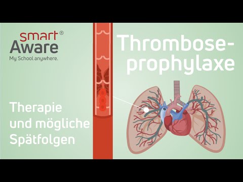 Thromboseprophylaxe: Therapie und mögliche Spätfolgen | Fachfortbildungen in der Pflege | smartAware