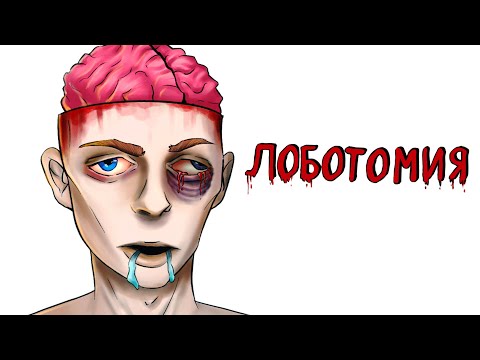 Лоботомия 💉🧠 | Рисованная история (Анимация)