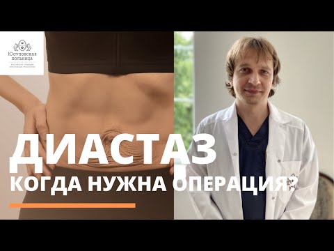 Video: Диастазды оңдоо үчүн камсыздандыруу төлөйбү?