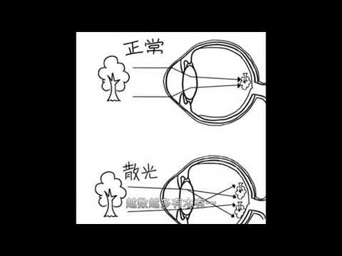 你是否还傻傻地分不清近视、远视、散光？简单有趣的图文来解惑！