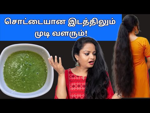 10 நாட்களில் முடி கொட்டுவது நின்று காடு போல வளர இதை செய்யுங்க!