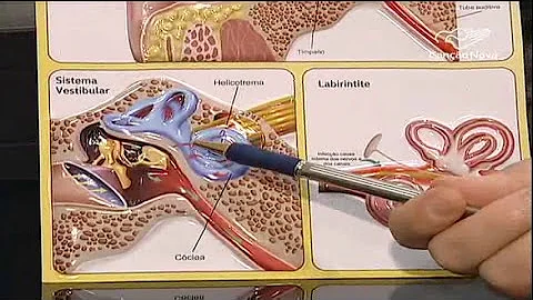 O que a poluição sonora pode causar no ser humano?