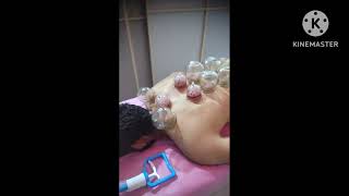 الجلسة الاولى.  علاج الشقيقة