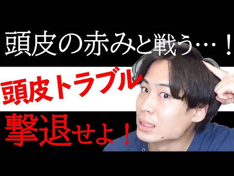 頭皮のしつこい【赤み・痒み】が起きる原因は？【頭皮トラブル対策法】