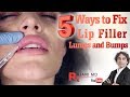 How to fix Lip Filler Bumps and Lumps-Why and How