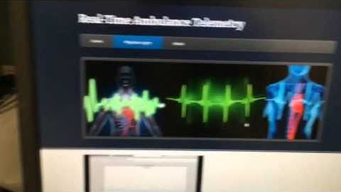 ECG Bluetooth Matlab The Regulators